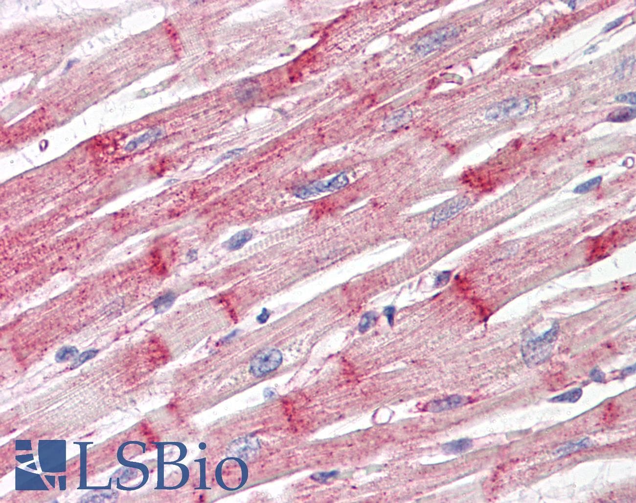 PathPlus™ NES / Nestin Antibody (clone 10C2)