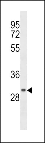 CCDC24 Antibody (aa1-30)