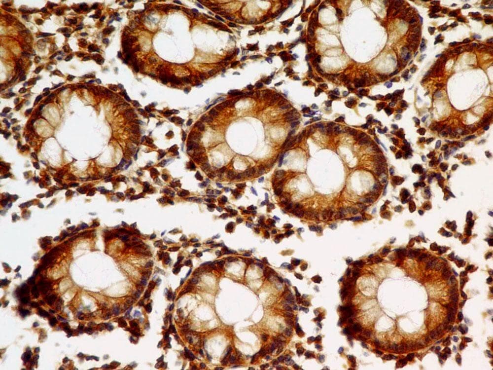 VIL1 / Villin Antibody