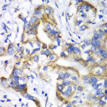 RPL9 / Ribosomal Protein L9 Antibody