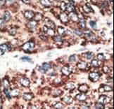 MMP14 Antibody (aa145-174)