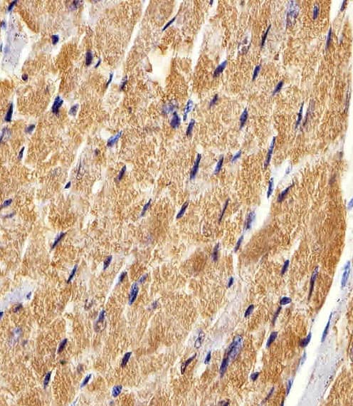 FABP3 / H-FABP Antibody