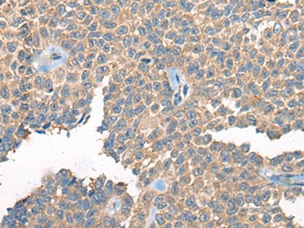 PPP3R1 / Calcineurin B Antibody