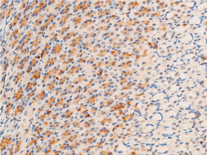 GSK3B / GSK3 Beta Antibody (phospho-Ser9)