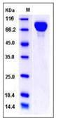 Mouse IL6ST / CD130 / gp130 Protein (Recombinant His,C-terminus)