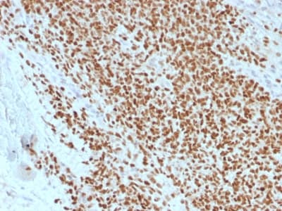 Recombinant Monoclonal Mouse anti-Human NKX2-2 Antibody (clone rNX2/1523, aa1-119, IHC)