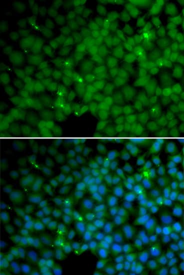 Polyclonal Rabbit anti-Human GGH / Gamma-Glutamyl Hydrolase Antibody (IHC, IF, WB)