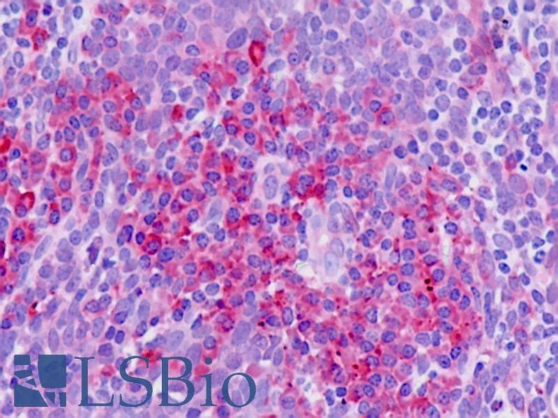IHC-plus™ Polyclonal Rabbit anti-Human SLC11A1 / NRAMP Antibody (aa250-276, IHC, IF, WB)