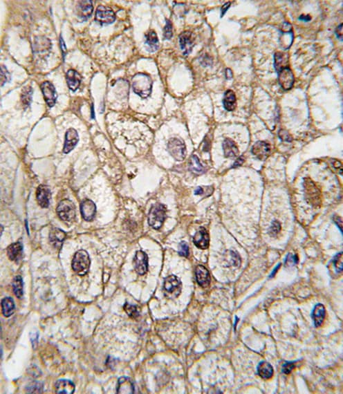 CYP2C9 / Cytochrome P450 2C9 Antibody (aa235-265)
