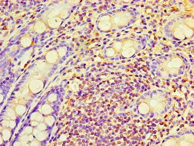 Polyclonal Rabbit anti-Human RAB6A / RAB6 Antibody (aa2-208, IHC)
