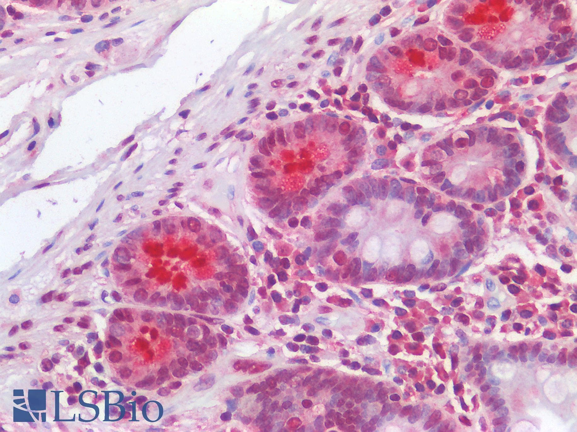 IHC-plus™ Polyclonal Rabbit anti-Human HMG1 / HMGB1 Antibody (IHC)