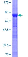 Human PTPN11 / SHP-2 / NS1 Protein (Recombinant GST)