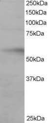 IHC-plus™ Polyclonal Goat anti-Human IRF6 Antibody (aa455-467, IHC, WB)