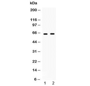 Polyclonal Rabbit anti-Human IFNAR1 / IFNAR Antibody (WB)
