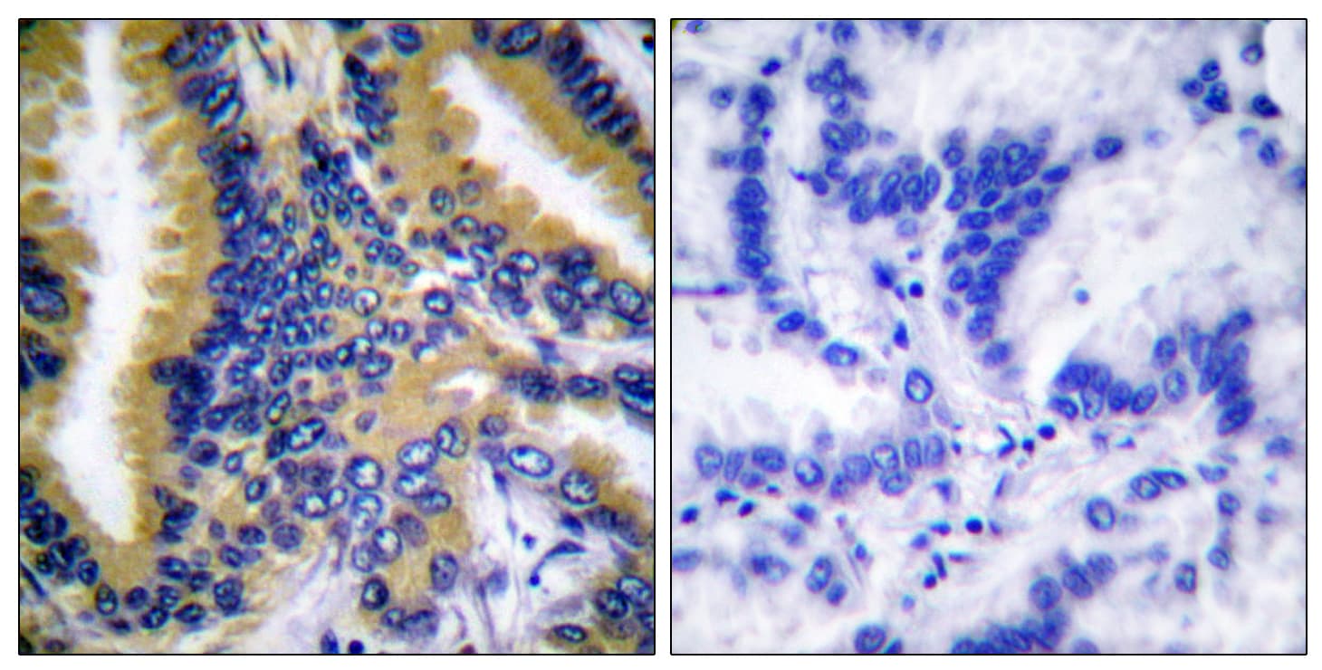 BIK Antibody (aa18-67)