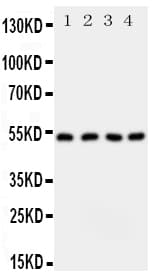 Polyclonal Rabbit anti-Human SPTLC1 / HSN1 Antibody (aa138-154, IHC, WB)