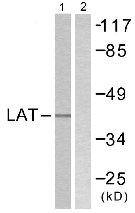 Polyclonal Rabbit anti-Human LAT Antibody (p171, WB)