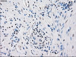 FRA-1 / FOSL1 Antibody (clone OTI12F9)