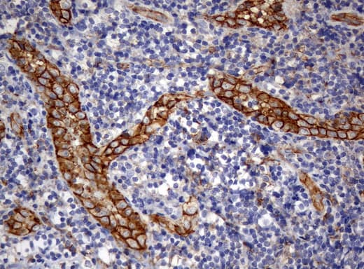 PECAM-1 / CD31 Antibody (clone UMAB32, Carrier-free)