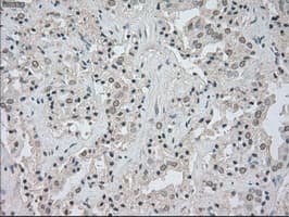 NTRK3 / TRKC Antibody (clone OTI24B3)