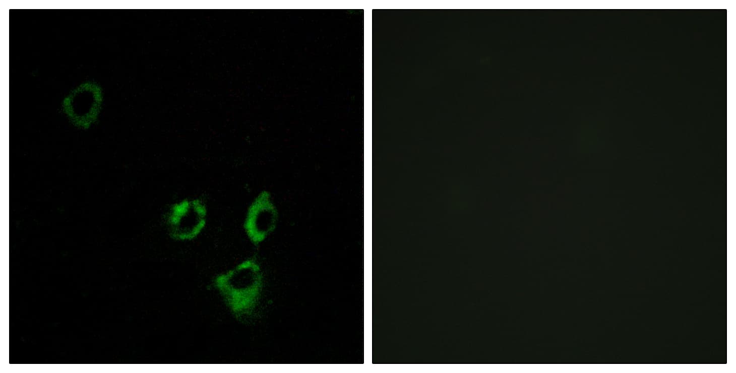 Polyclonal Rabbit anti-Human OR2T5 Antibody (aa66-115, IF, WB)