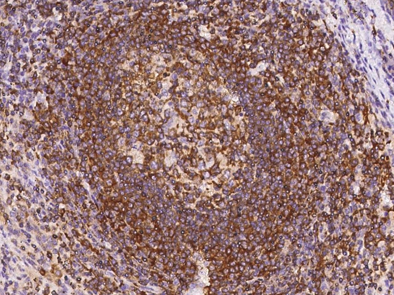 ARHGEF1 Antibody