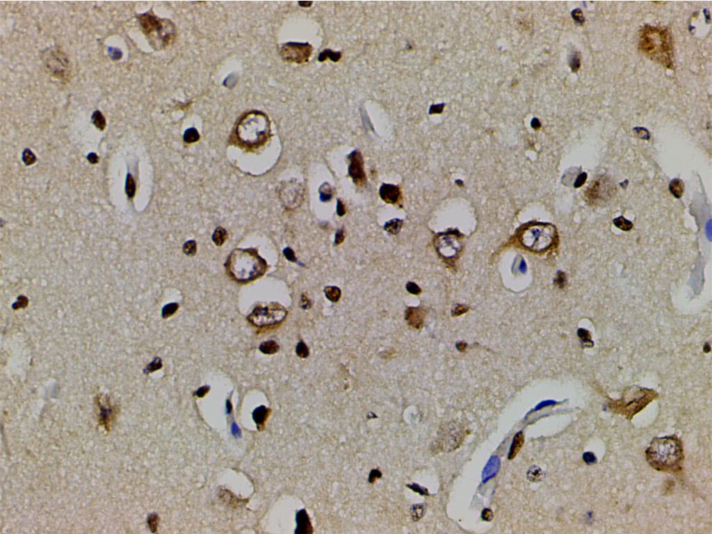 EFNB2 / Ephrin B2 Antibody