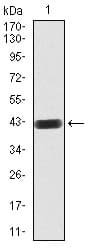 RAB8A / RAB8 Antibody (clone 7G8B11)