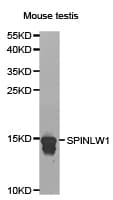 Polyclonal Rabbit anti-Human SPINLW1 / EPPIN Antibody (IHC, WB)