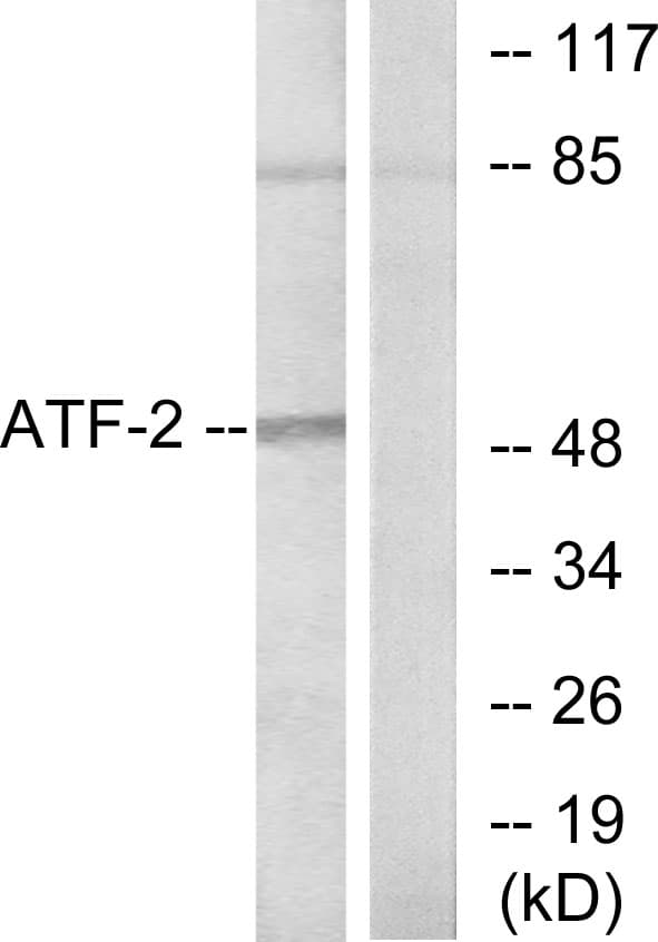 Polyclonal Rabbit anti-Human ATF2 Antibody (aa38-87, IHC, WB)