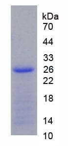 Human CTH / Cystathionase Protein (Recombinant His-T7)