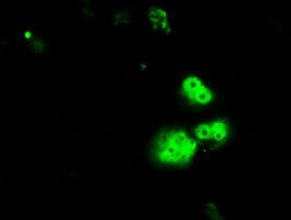 RPA2 / RFA2 / RPA34 Antibody (clone OTI1H10)