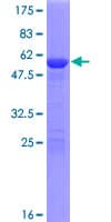 Human HSD17B14 Protein (Recombinant GST)