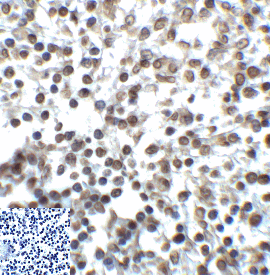 TIGIT Antibody (clone 4A11)