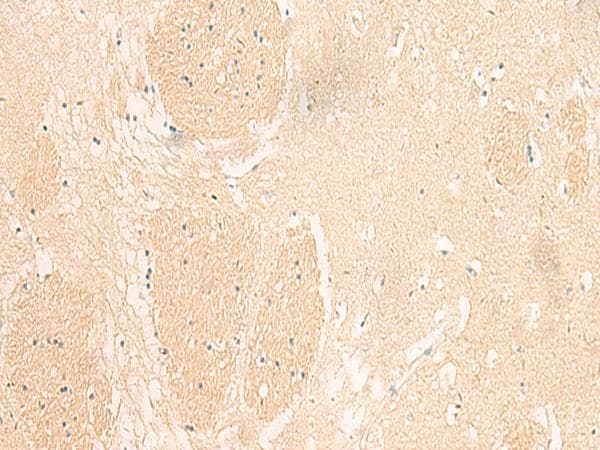 IL37 Antibody