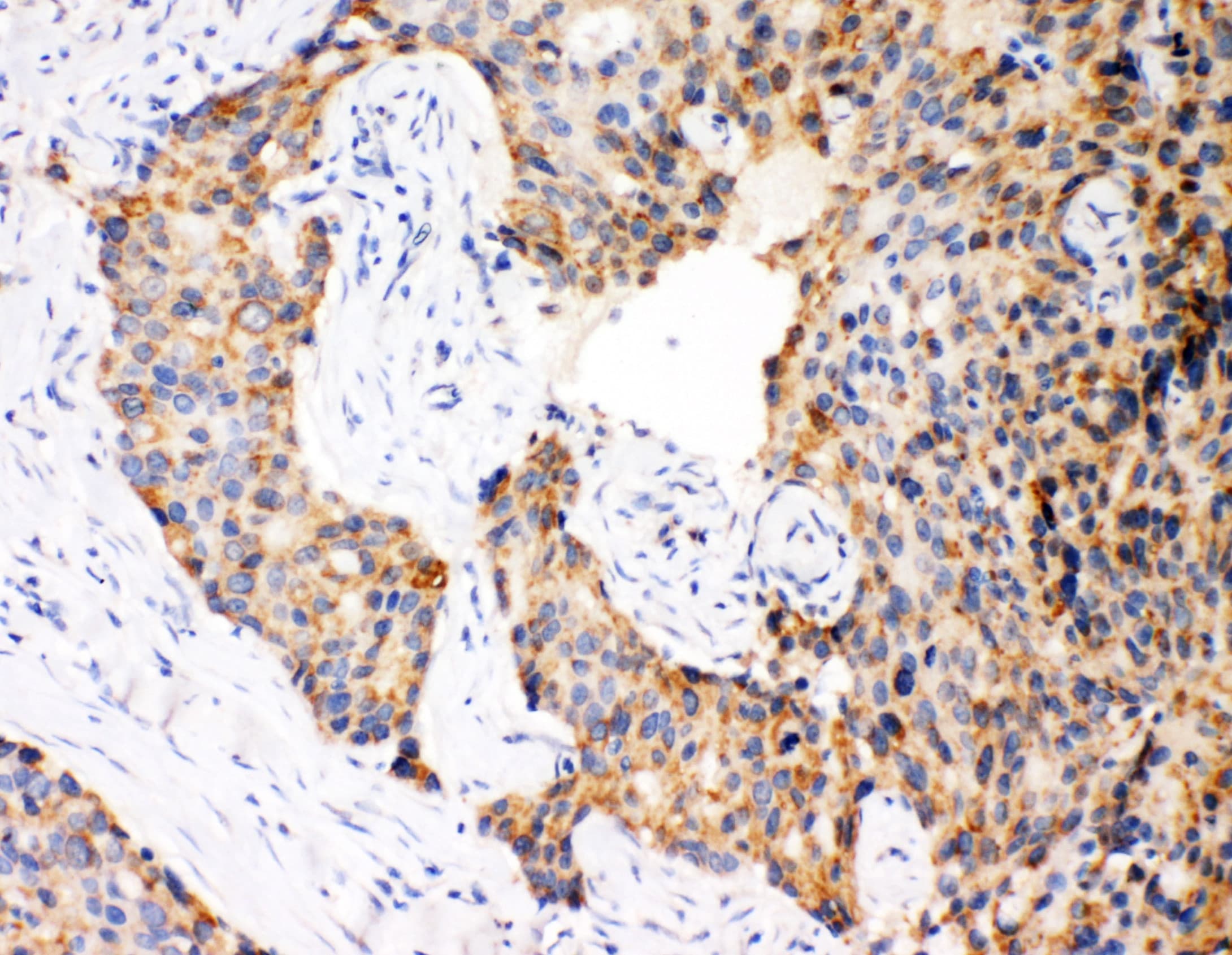 Polyclonal Rabbit anti-Human CASP12 / Caspase 12 Antibody (aa71-84, IHC, WB)