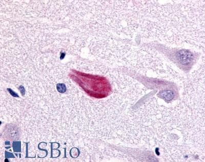 PathPlus™ CDC7 Antibody (Kinase Domain)