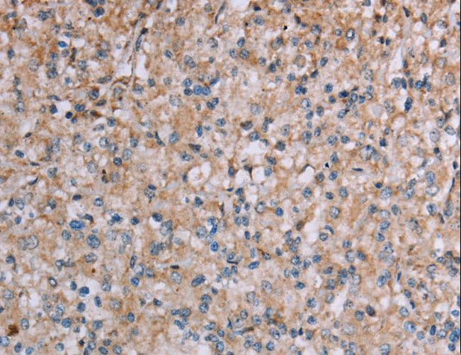 Polyclonal Rabbit anti-Human PLXNA4 / Plexin A4 Antibody (IHC)