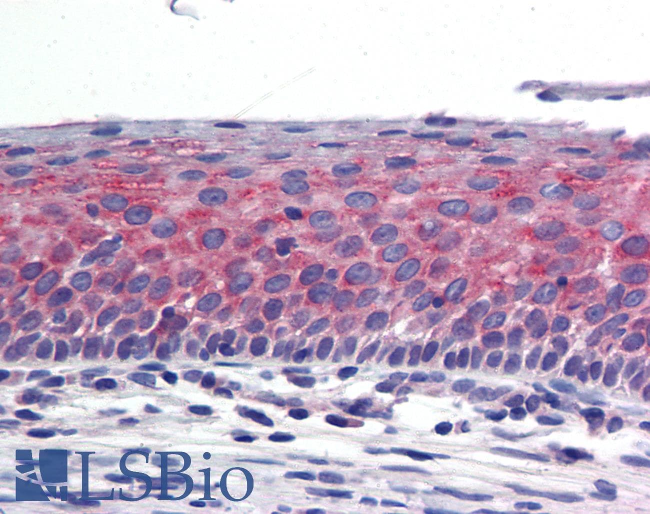 KRT16 / CK16 / Cytokeratin 16 Antibody (aa251-300)