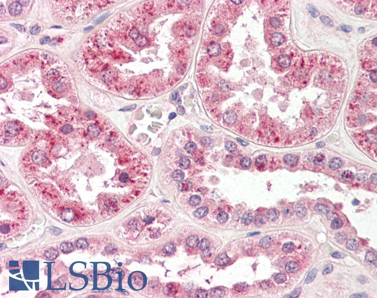 SPP1 / Osteopontin Antibody (clone 1B20, Biotin)