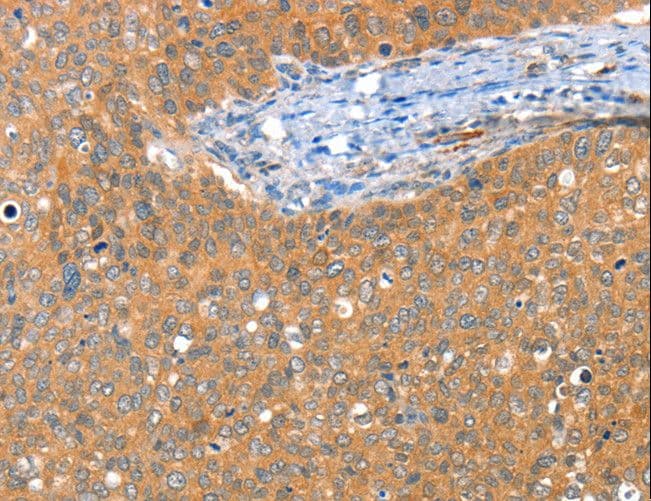ACY3 Antibody