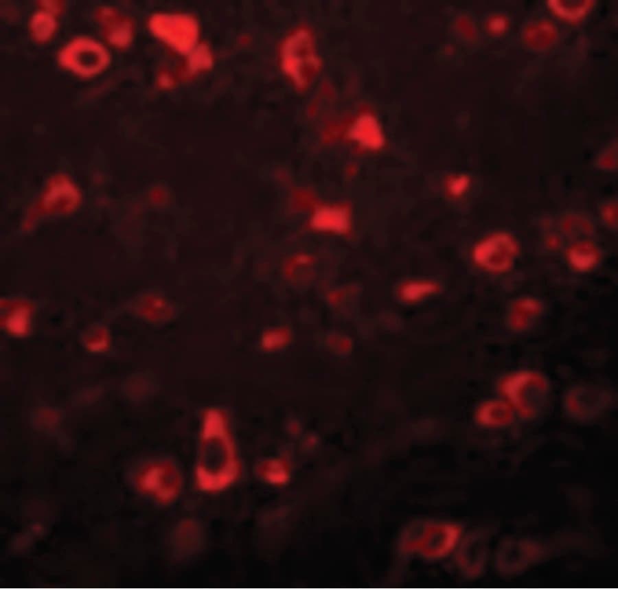 IHC-plus™ Polyclonal Rabbit anti-Human GAREML Antibody (IHC, IF, WB)