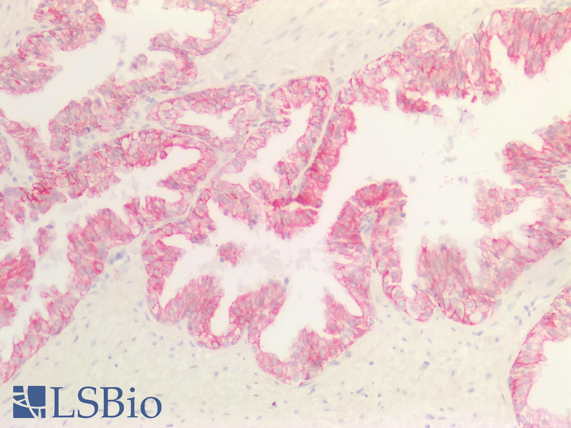 PathPlus™ Monoclonal Mouse anti-Human Cytokeratin AE1+AE3 Antibody (clone AE1 & AE3, IHC)