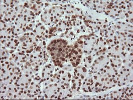 TRMT2A Antibody (clone OTI3D8, Carrier-free)