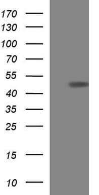 TXNDC5 / ERP46 Antibody (clone OTI1D4)