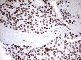 CD5 Antibody (clone OTI10F4)