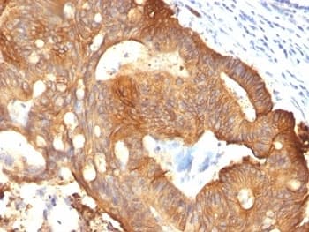 KRT8 / CK8 / Cytokeratin 8 Antibody (clone B22.1)