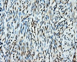 Monoclonal Mouse anti-Human SRR / Serine Racemase Antibody (clone OTI5D10, IHC, WB)