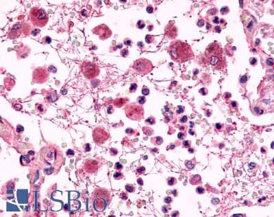 PathPlus™ Polyclonal Rabbit anti-Human ADGRE2 / EMR2 Antibody (N-Terminus, IHC)