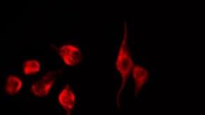 Polyclonal Rabbit anti-Human EPN3 Antibody (IHC, IF, WB)